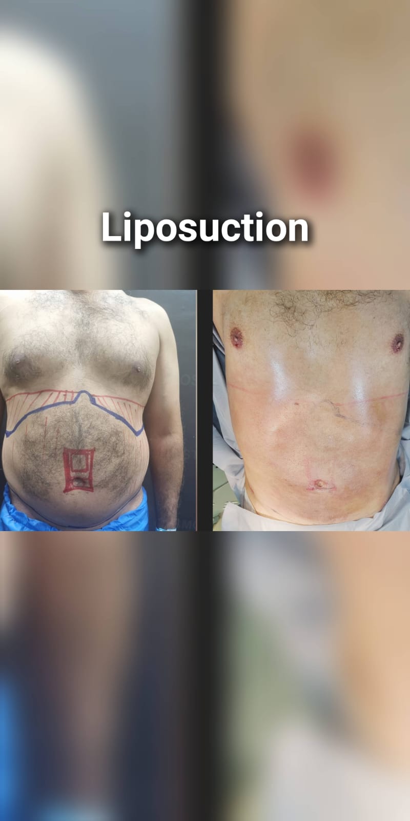 Before & After 26